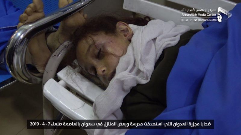 "الصحة" اليمنية للمجتمع الدولي: لتقديم قيادات العدوان للمحاكم الدولية
